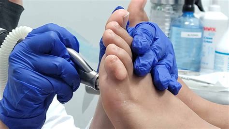 The Benefits Of Medical Pedicures Feet First Clinic