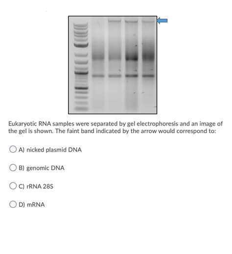 Solved Eukaryotic RNA samples were separated by gel | Chegg.com