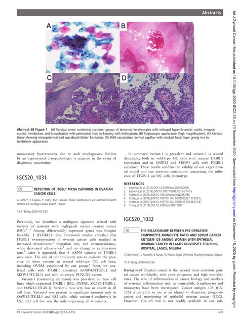 PDF 69 Detection Of ITGBL1 MRNA Isoforms In Ovarian Cancer Cells