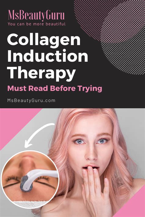 Handy Guide To Collagen Induction Therapy Skin Needling Collagen