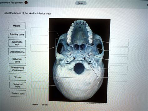 Solved Homework Assignment Label The Bones Of The Skull In Inferior