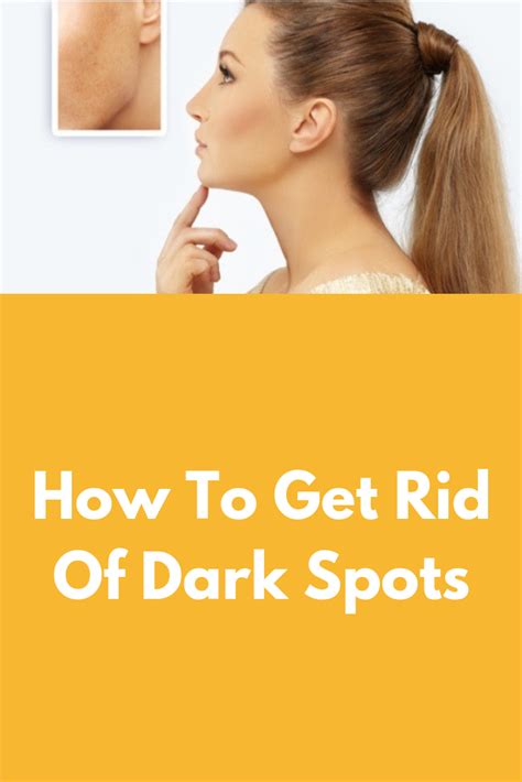 How To Get Rid Of Dark Spots Dark Spots Are Visible Marks On The Skin They Can Be Covered With