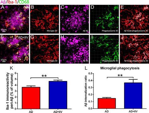 Iiv Treatment Enhanced Microglial Phagocytosis Ability In App Ps Mice