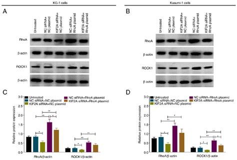 Successful Transfection Of Rhoa Overexpression Plasmid In Aml Cells