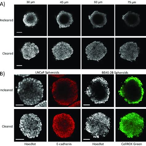 Confocal Fluorescence Imaging Of Spheroids Is Improved By Clearing A