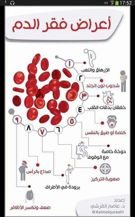 مرض فقر الدم أحدث الخلفيات