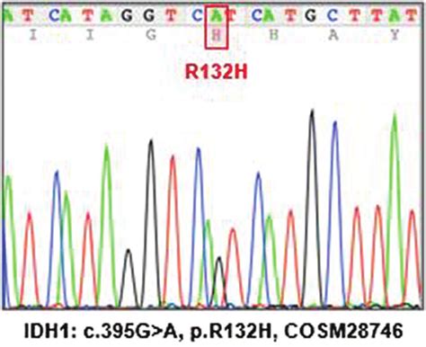 Dna Sequencing Of The Idh Gene The Idh R H Mutation Was Detected