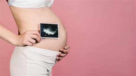 La Futura Madre Muestra Una Imagen De Ultrasonido Del Feto En La C Mara