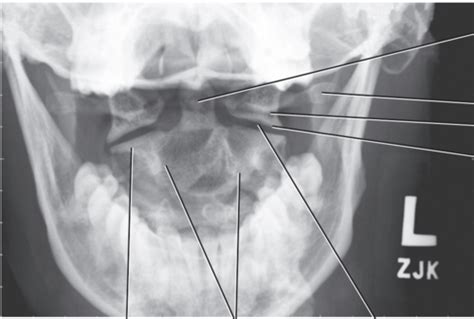 Procedures Chpt Anatomy Review Radiographs Ed Iv Flashcards Quizlet