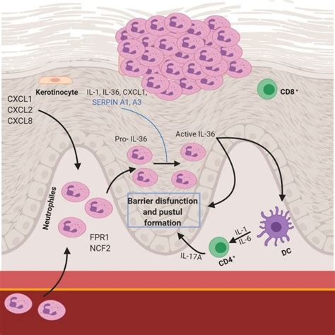 Plaque Type Psoriasis Pathogenesis Principal Hypothesis Download Scientific Diagram