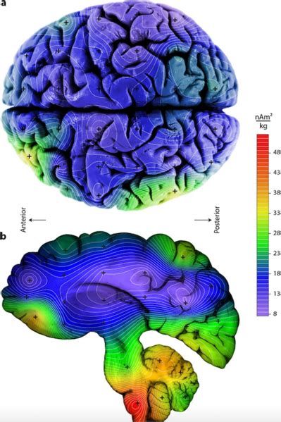 How Sides Of The Brain Adapt If They Cant Talk To Each Other