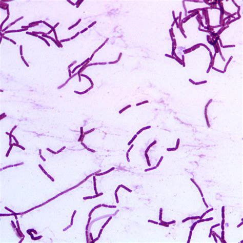 Staphylococcus Aureus Morphology Visualised Using Gram Staining 10