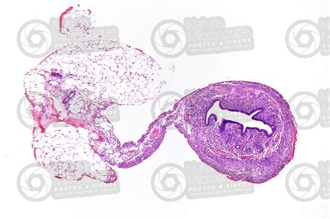 Rat Uterus Transverse Section 32x Rat Mammals Reproductive