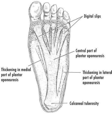 Lateral Plantar Fascia Foot Pain Sale Online | bellvalefarms.com