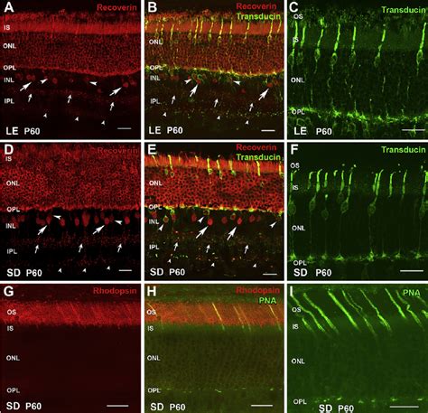 Normal Retina Controls E Photoreceptors Recoverin Cone Transducin