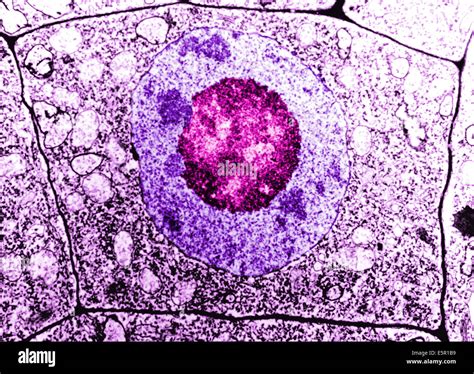 Electron Microscopy of a normal human cell, The cell membrane, nucleus ... 