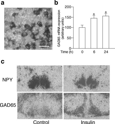 Effects Of Insulin On Gad65 Mrna Expression In The Arcuate Nucleus In