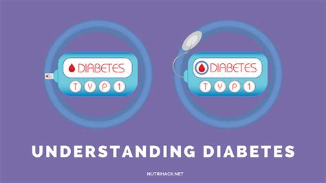 Understanding Diabetes In A 2020 Study Of Nearly 85000 By