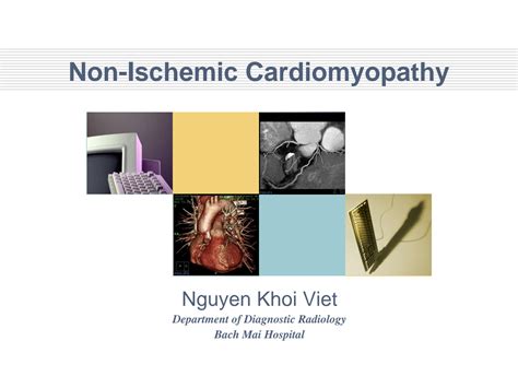 SOLUTION Non Ischemic Cardiomyopathy Studypool