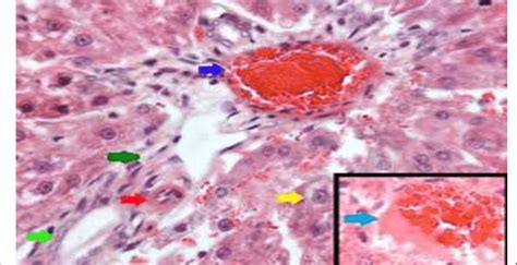 Showing Photomicrograph Of Histological Section Of Portal Area Of Liver