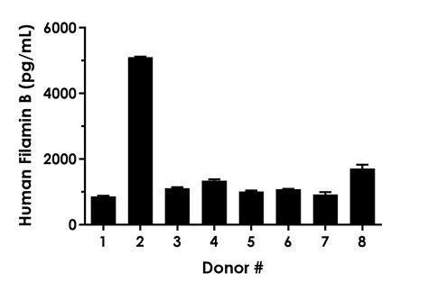 人Filamin B ELISA试剂盒- Extracellular| Abcam中文官网 