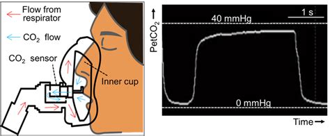 A system of measuring end-tidal PCO2 during non-invasive positive ...