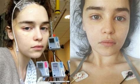 Emilia Clarke Shares Photos Of Brain Surgery Recovery | EveryEvery