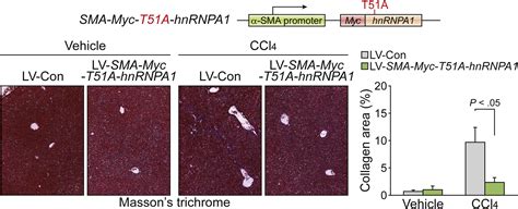 Endoplasmic Reticulum Stress In Hepatic Stellate Cells Promotes Liver