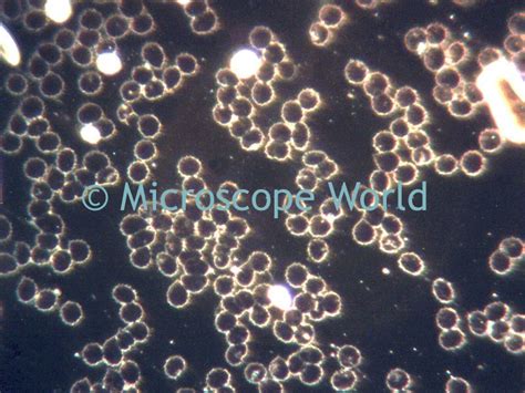 Microscope World Blog: Darkfield Microscopy Slide Preparation ...