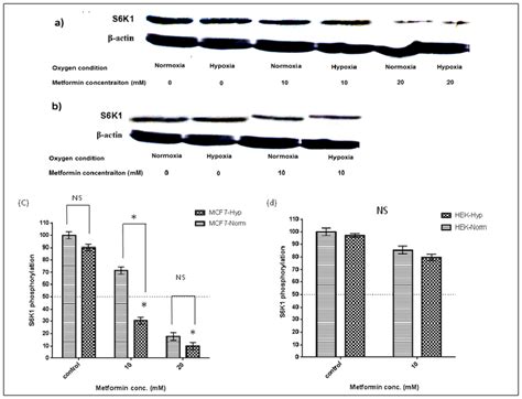 S6k1 Phosphorylation In Cancer And Non Cancerous Cellsa Western Blot Download Scientific