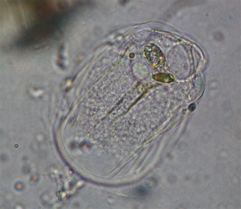 Amoebozoa (classification phylogénétique) - Définition et Explications