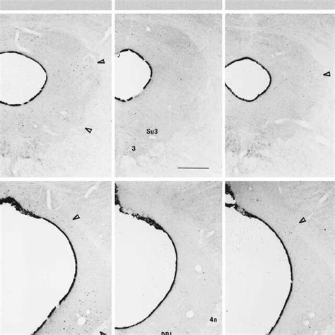 Photomicrographs Of M Thick Pag Sections Showing The Distribution