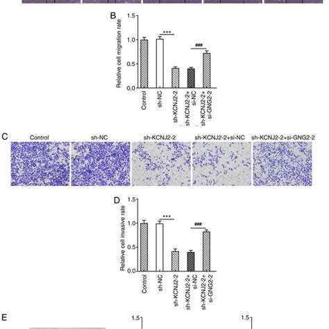 Interfering With Kcnj Inhibits The Emt Of Papillary Thyroid Carcinoma