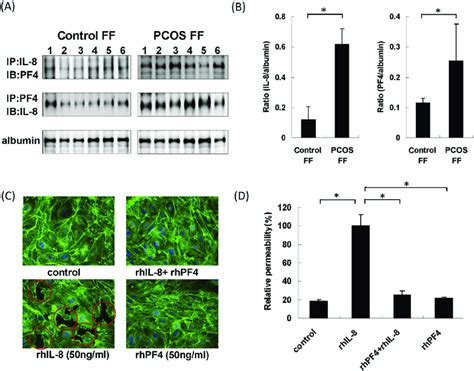 Increased Pf Il Protein Complex In The Ff Of The Pcos Group The