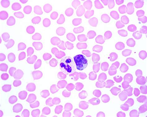 Human Blood Smear. Neutrophil and Monocyte Stock Image - Image of ...