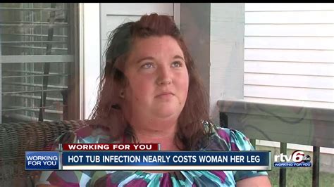 Hot Tub Infection Nearly Cost An Indiana Woman Her Leg