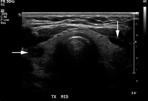 Clinical Images Four Dimensional Computed Tomographyfuture Of