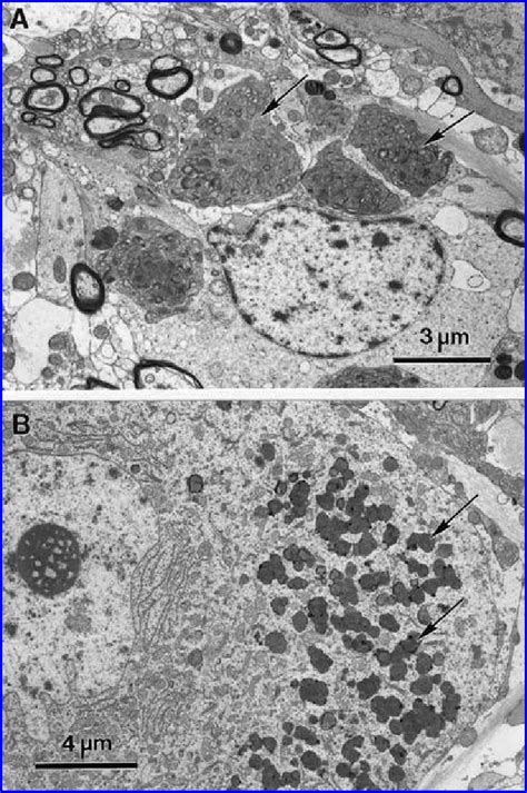 Electron Micrographs Of Cells In The Purkinje Cell Layer A And The