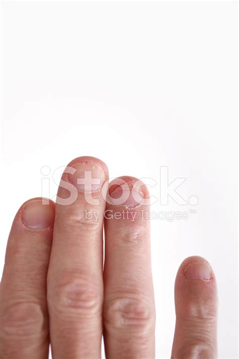 Biting Fingernails Stock Photo | Royalty-Free | FreeImages