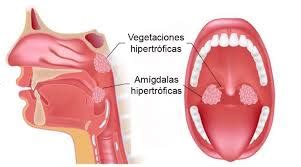 Amígdalas Qué son Anatomía función fisiología y mucho más