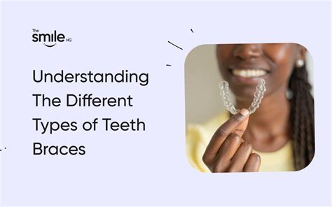 Understanding The Different Types of Teeth Braces - The Smile HQ