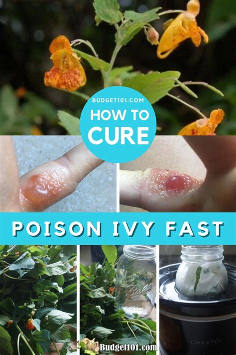 Overnight Poison Ivy Remedy By ™ Poison Ivy Remedies