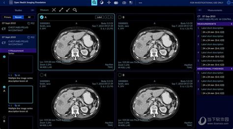 Radiant Dicom Viewer图片浏览器 V469 免费版radiant Dicom Viewer 469优享版 好玩软件