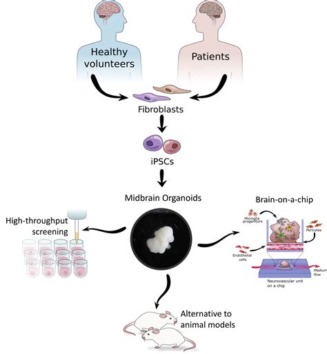 Brain organoid - Lehtonen lab/ Human Brain Disease Modelling Research Group