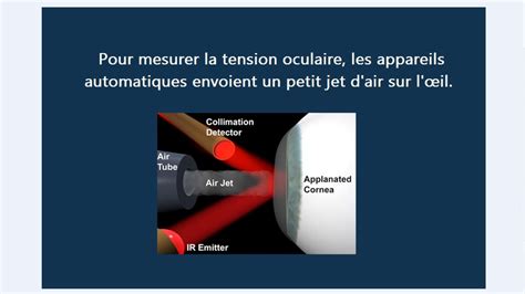 Glaucome et méthodes de mesure de la pression oculaire YouTube