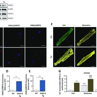 Implication Of MAMs In MAO A Induced MitoCa 2 Increase A