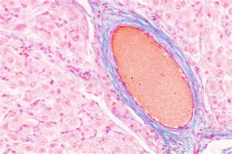 Histological Ovary Testis And Sperm Human Cells Under Microscope