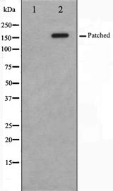 Anti Ptch Patched Antibody Rabbit Anti Human Polyclonal Lsbio