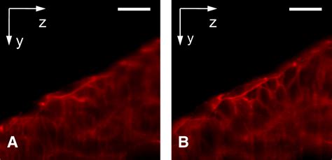 Sted Spim Stimulated Emission Depletion Improves Sheet Illumination