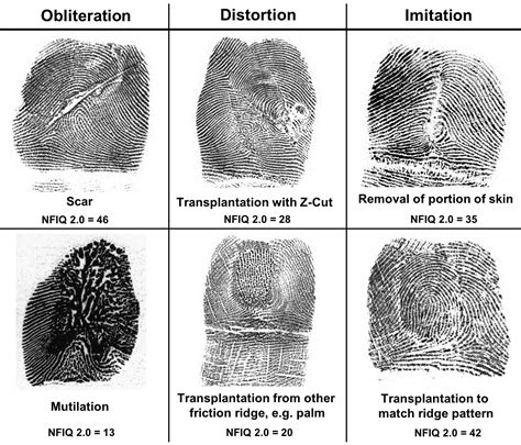 Altered Fingerprints Detection And Localization Deepai